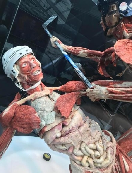 福尔马林浸泡人体器官图片