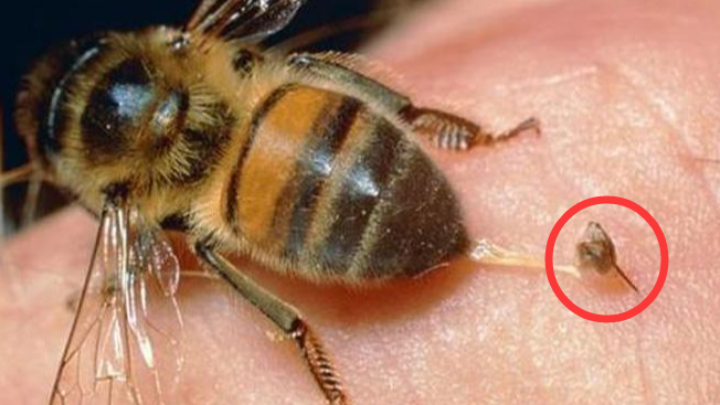 蜜蜂毒刺拔出来图片图片