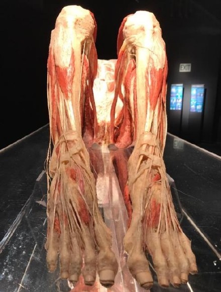用真人捐献的遗体制作的人体标本