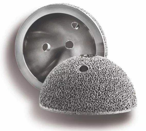 几十万个案例,3d打印髋臼杯走过十多年历史