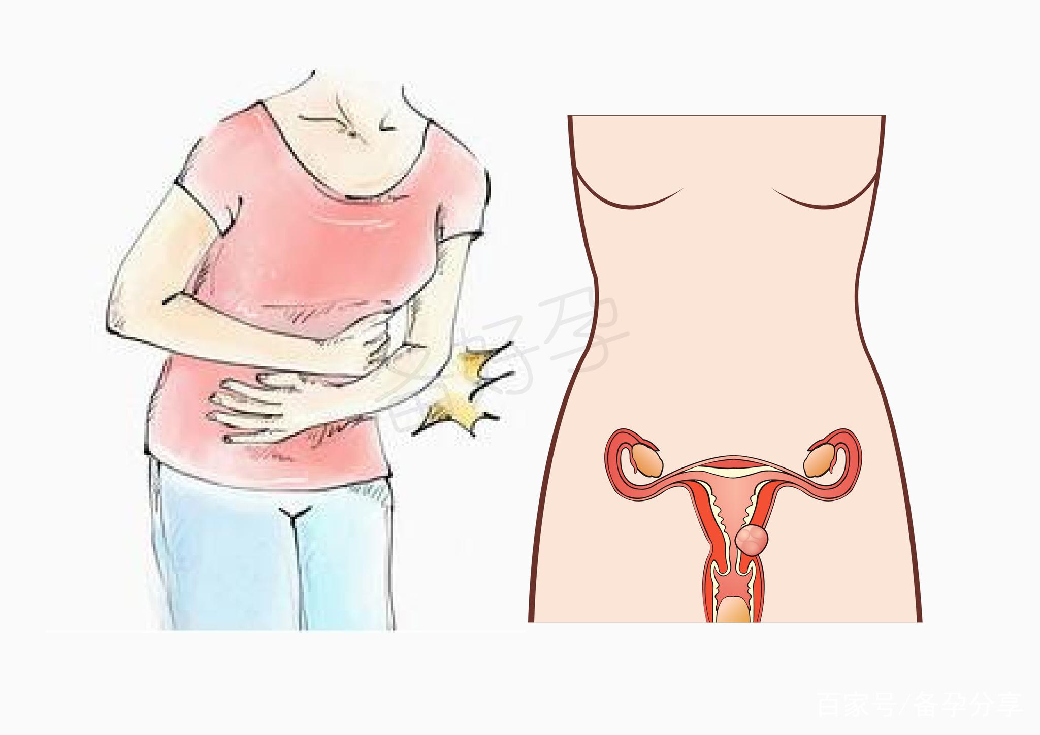 生化妊娠刚怀孕就来月经说明夫妻存在哪些问题