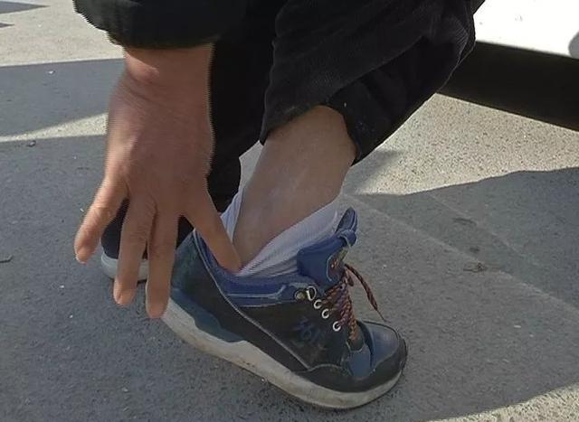 行业 正文 图片如下: 详情如下: 张大爷的脚踝上确实有一点擦痕,不过