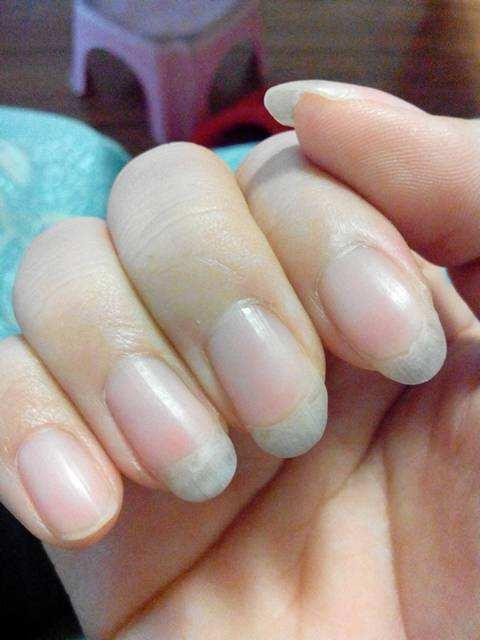 有这8大身体状况的人,说明你特别健康|指甲|身体状况|睡眠_新浪新闻