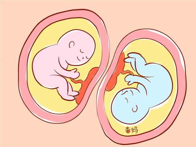 异卵双胞胎是什么图片