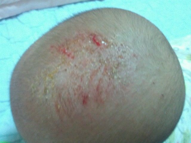 90后宝妈太爱干净,出生30天宝宝被送医院,医生的眼神都变了