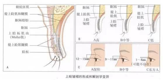 在眼瞼的遺傳上,單,雙眼皮(眼瞼)是受基因控制的,雙眼皮由顯性基因a