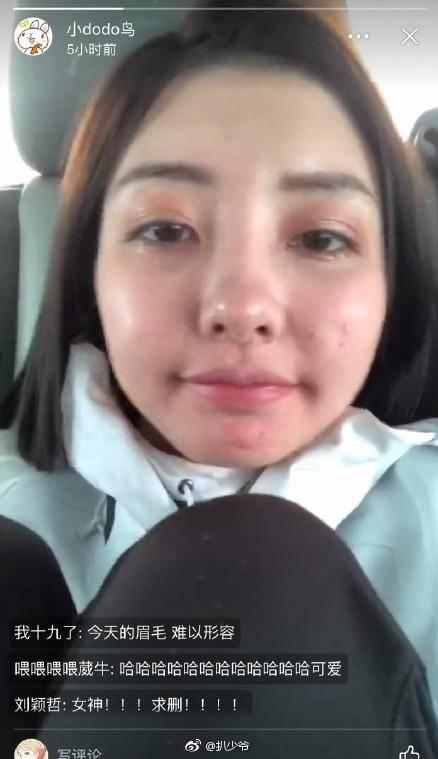 豆得儿无ps素颜照满脸痘这么丑,王思聪当初怎么看上她的?