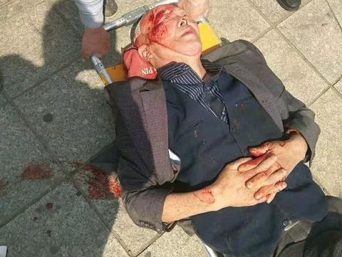 招远人,这位老人骑车摔伤,请大家帮助通知他的家人!