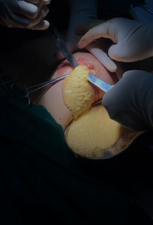 奥美定比我们想象的更可怕