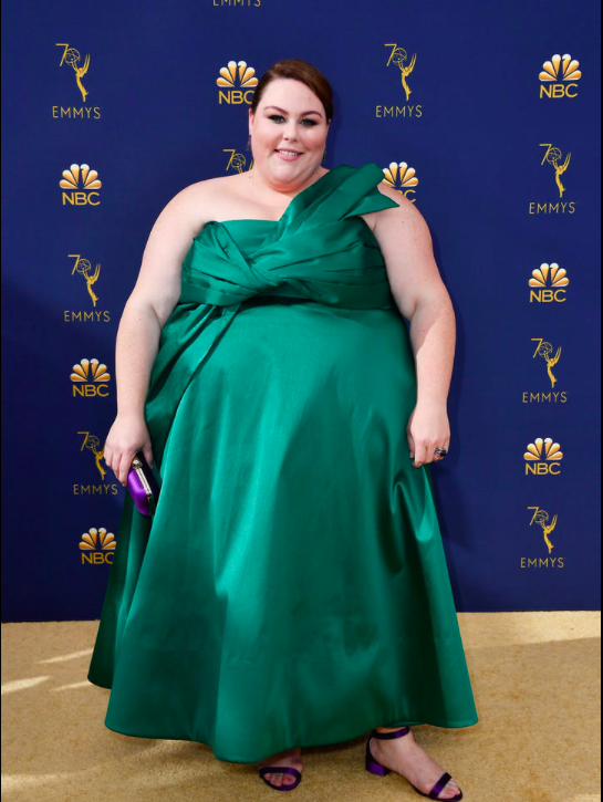 好莱坞巨型女星体重400斤,美恐畸形秀中饰演肥胖怪人