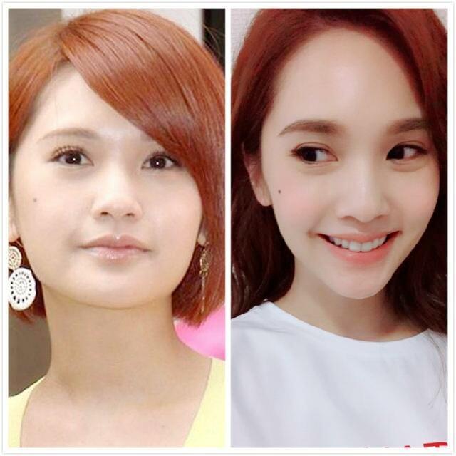 除了她,好多偶像剧女星都成了v型脸!