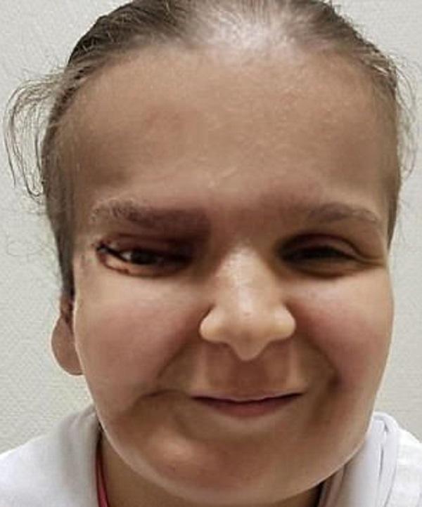 外国女孩被亲妈嫌丑, 要回家必须整容