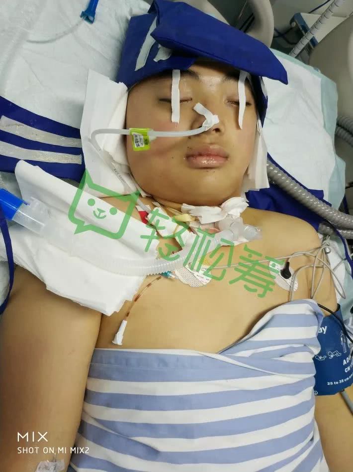 涡阳龙山两死一伤惨案,孩子至今昏迷!急求社会