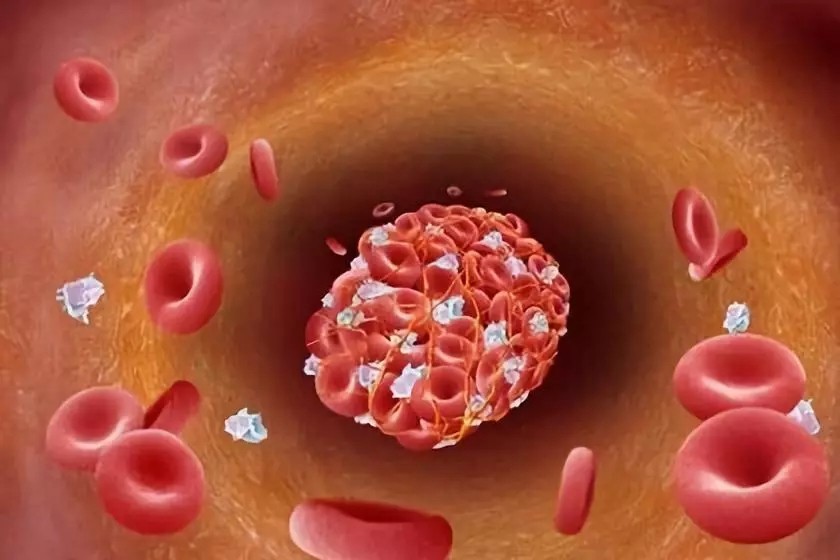 阿司匹林,抗血栓药物中的霸主