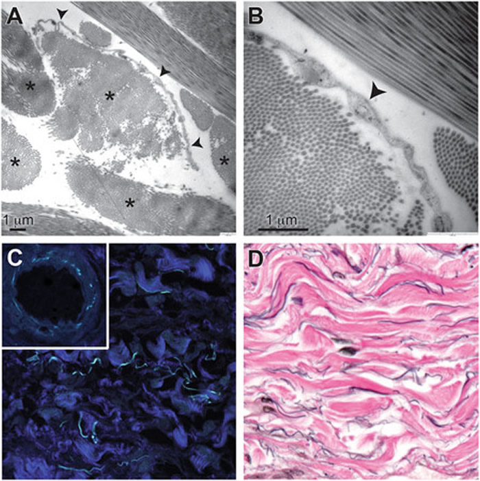 科学家发现人体新器官"间质" 与癌细胞扩散有关