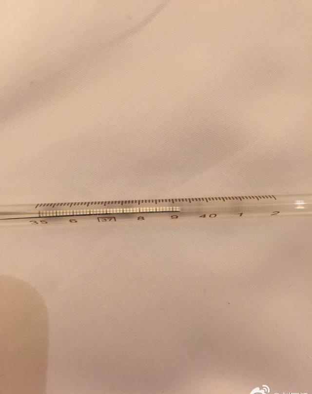 张继科脚肿高烧387度仍横扫对手个人赛大比分胜利堪称完美