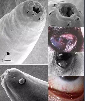 半岁宝宝眼睛里爬出蠕白虫! 都怪妈妈把孩子和它放一块!