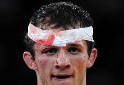 看到这些,你就知道有多"残酷"多"暴力"