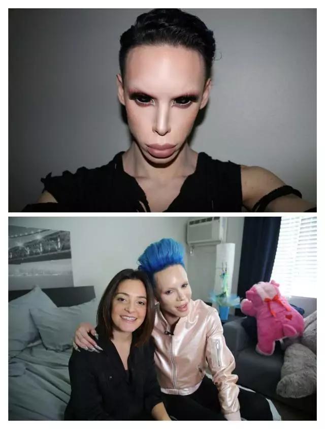 整容狂魔vs整容狂魔,刘梓晨是小儿科,他"不男不女"是外星人?