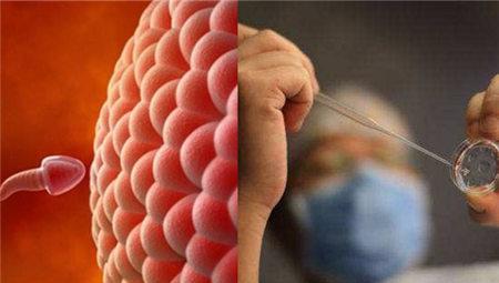 技术引进! 什么是人工助孕 "斗折蛇行"-第1张图片-培峰博客