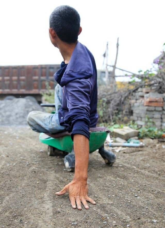 下肢萎缩后俩个车轮成了他的腿,普通人很难平衡看了心酸|赶集|车轱辘