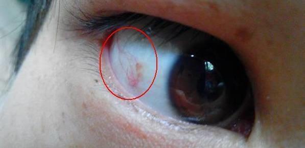 一旦眼睛出现这8种症状要当心, 这可能是大病的征兆, 要及时就医