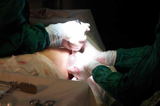 媳妇取环第二天,丈夫就强求同房,后来亲手将媳妇送往医院!