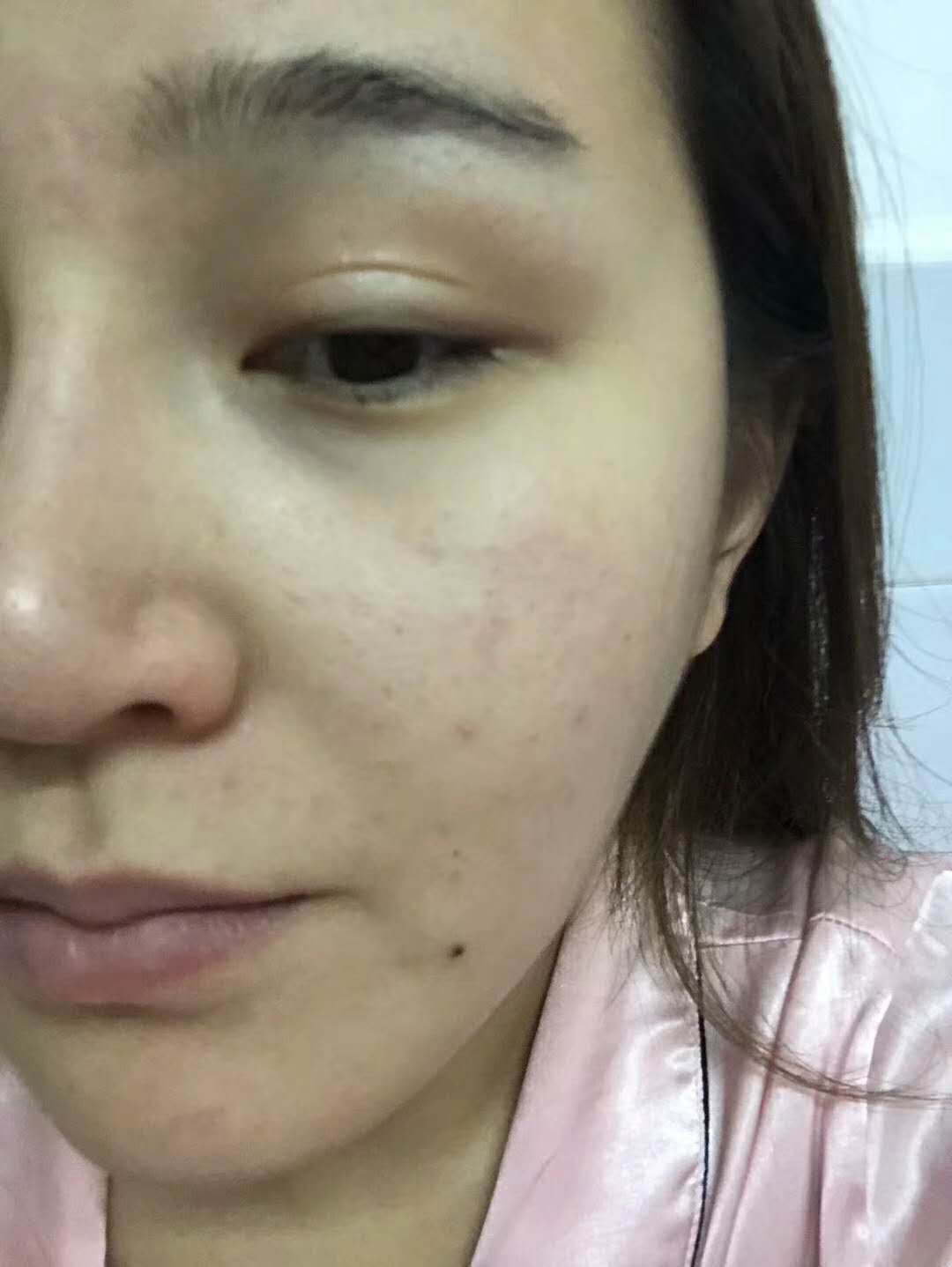 皮肤暗黄粗糙长痘用了很多护肤品却发现然并卵