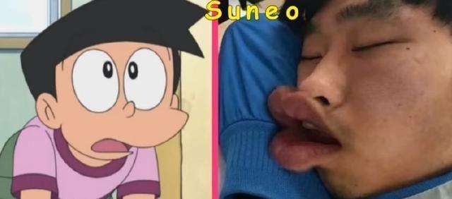 哆啦a梦真人版:静香不愧是童年女神!小夫堪称毁容!