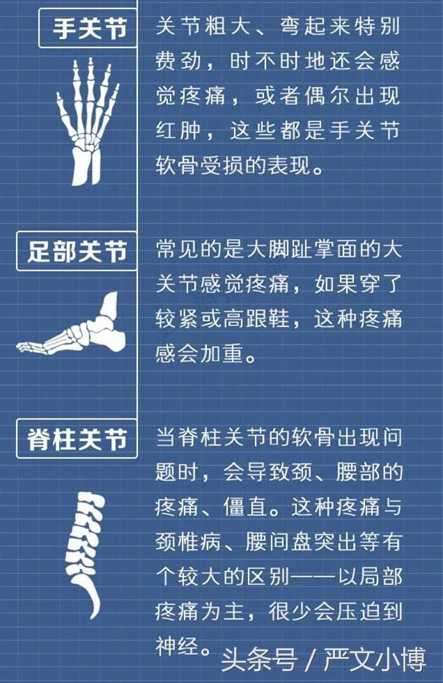 为了您的身体健康,请保护好您身体的每一块软骨