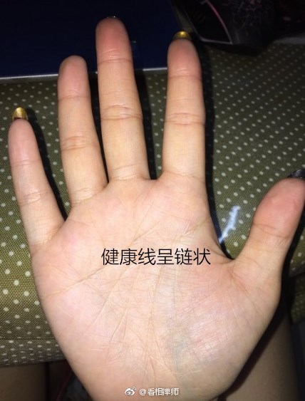 手相中,健康线是一条起于手掌底部,朝水星丘延伸的纹路
