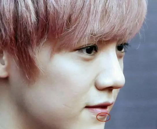 只有杨幂和娘娘的没人知道原因,而他最凄惨|杨幂|娘娘|疤痕_新浪新闻