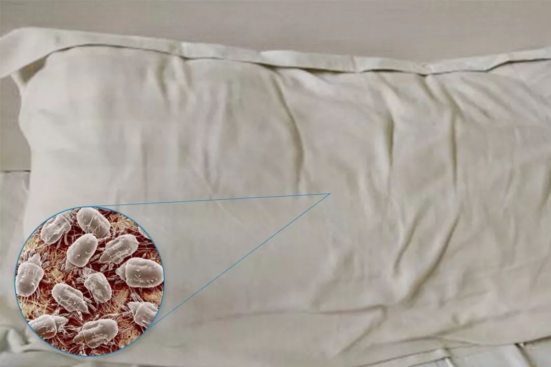 床上螨虫多不多从3点看出并成功逼退网友一亿螨虫不早说