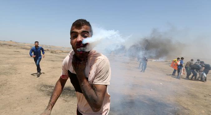 男子面部被催泪弹击中,卡在喉咙后,却仍在不停喷射