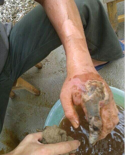 珍爱生命,远离毒蛇,毒蛇咬伤的图片