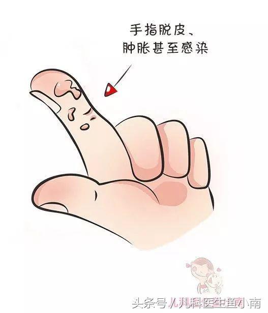 宝宝为啥爱吃手?爸妈别急着打,医生的建议爸妈值得一看|宝宝|爸妈|手