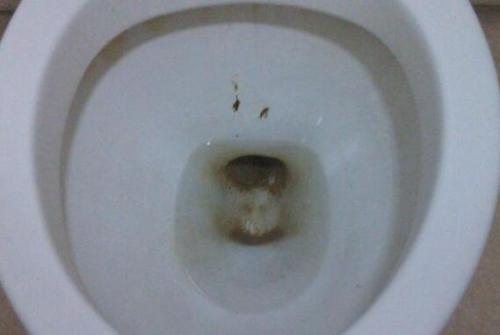 便便粘马桶就是肠癌?错,大便里"有它"才是,别瞎操心!