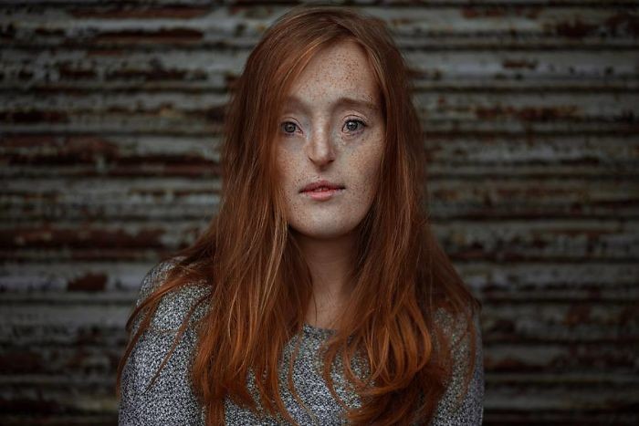 这些唯美的写真照来自一位天生面部畸形的女孩