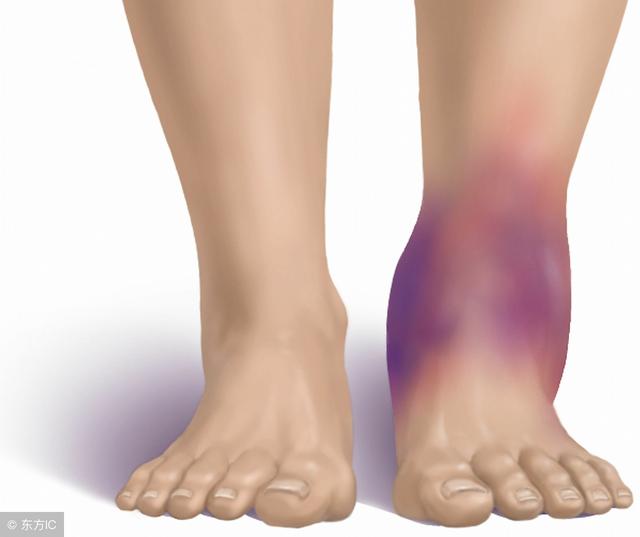 4种身体信号,警惕血管要出事,3件事,再难也要做