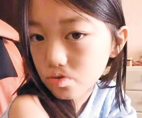 先天唇裂, 3岁熟背金刚, 9岁成网红小达人, 今比姐姐美没人嘲笑她