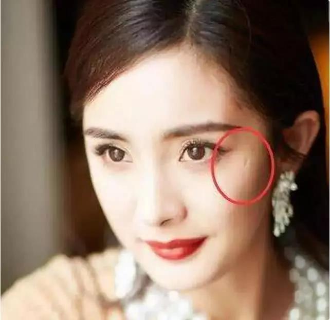 杨幂不管怎么美,依旧挡不住眼角下的疤痕,很多网友说事整容留下的