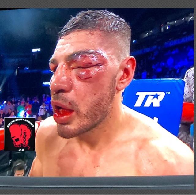 据了解,这场比赛发生在7月1日,是在两名超轻量级拳手之间展开,一位是