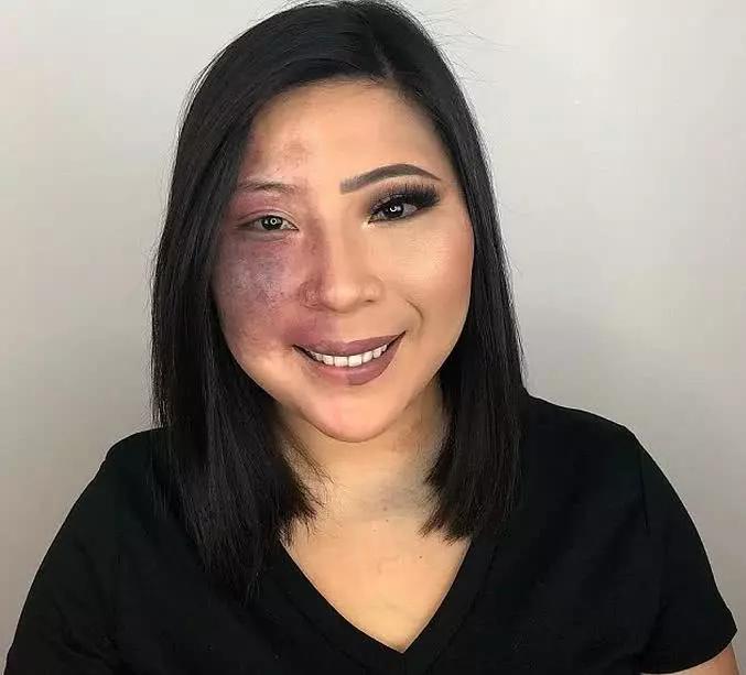 女子满脸胎记从小遭"歧视",苦练化妆术后,先成知名"网红"!