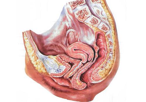 b超提示"盆腔积液"会影响怀孕吗?