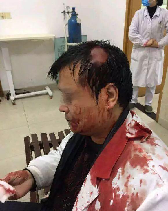 「恶性伤医」心寒!又一位医生被打伤,鲜血染红了白大褂!