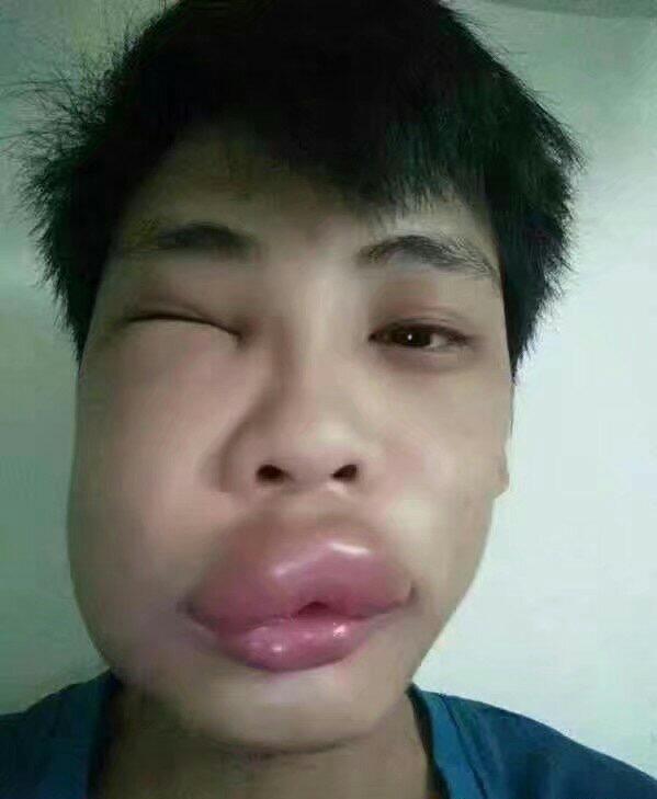 兄弟你肿么了,水嫩嫩的嘴唇好有魅力!