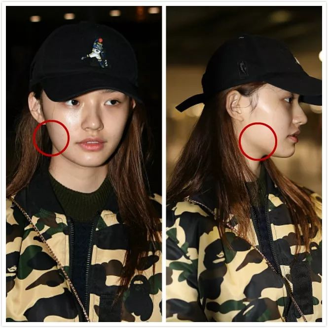 什么鬼,林允饿晕在片场?瘦脱相的她又暴露了这个颜值bug!