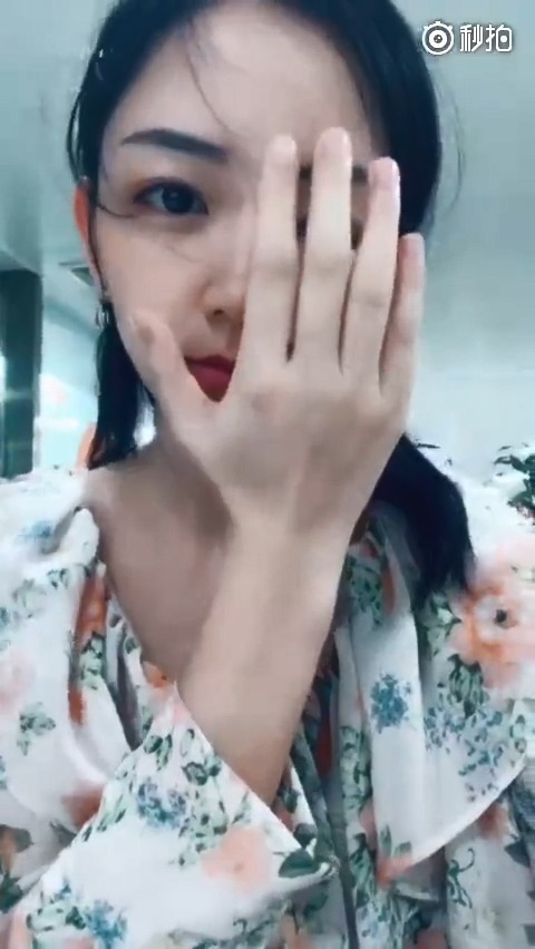 一般来说眼白有痣并不多见,因为眼白上的痣又