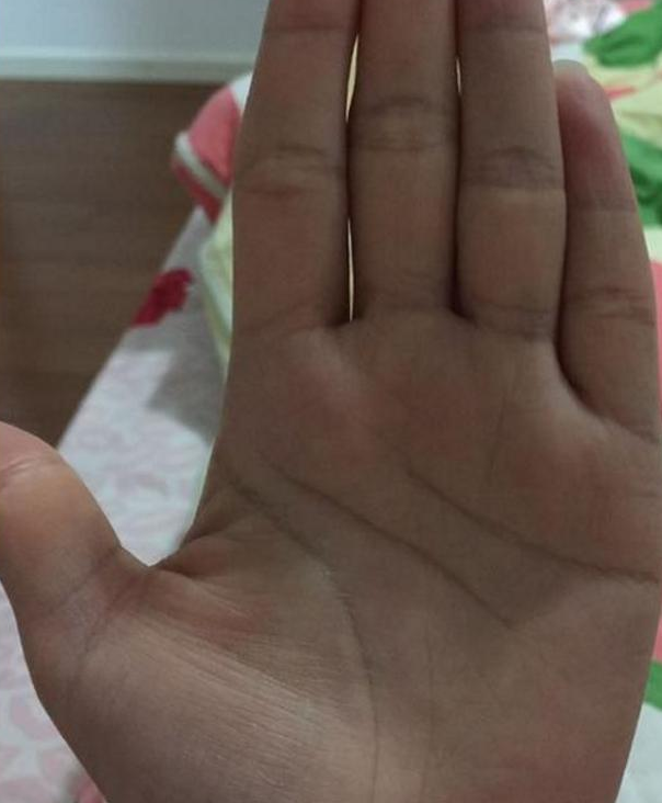 手掌三丘是在手掌靠近手指的位置往往有三个像小山丘一样的鼓包,手相