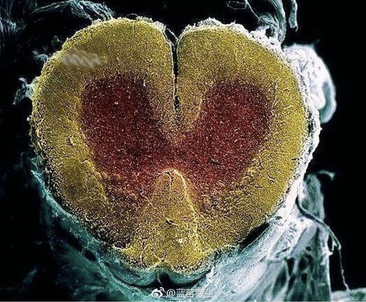 电镜下的脊髓,红色是神经元,黄色是神经束,白色为硬脑膜